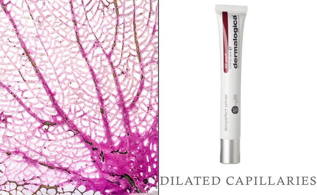 Dilated Capillaries_Dermalogica Products2